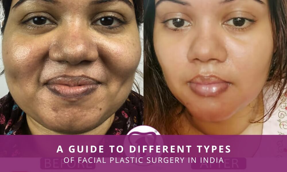 Different-types-of-facial-plastic-surgery-2