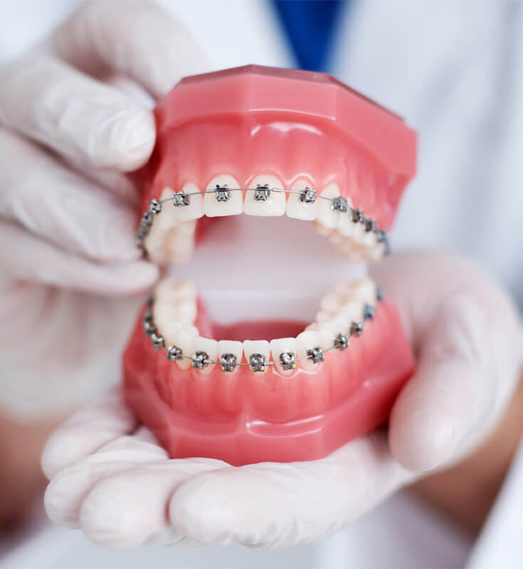 orthodontic-treatment